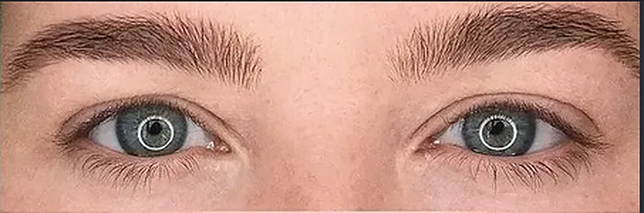 Classic eyelash extensions — one extension per natural lash for a natural mascara-like look